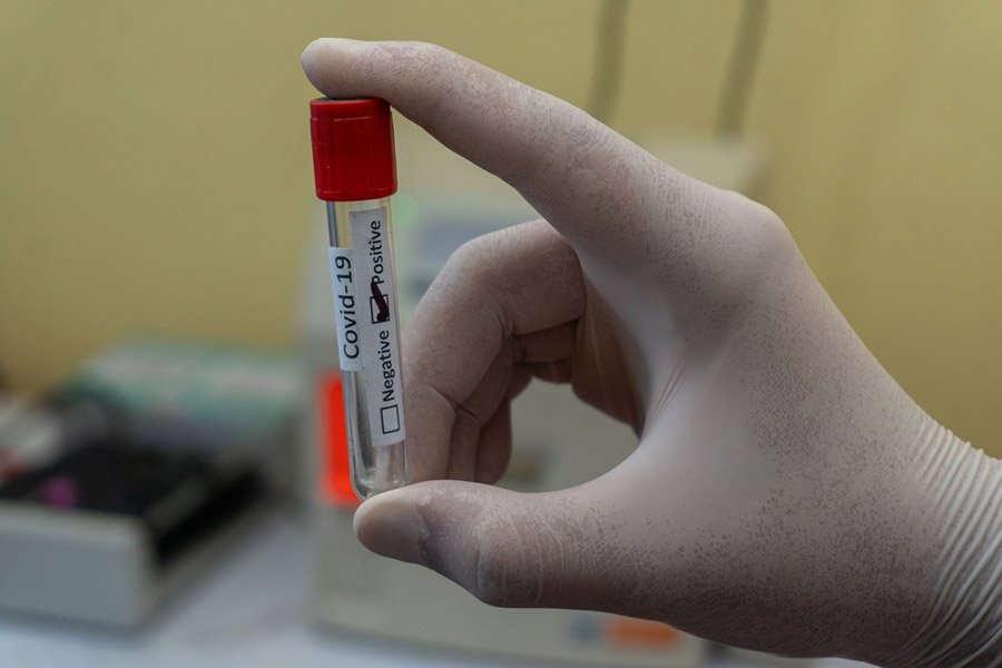 What Is Private Cord Blood Banking