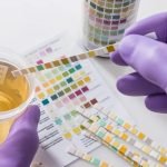 Does Suboxone Show Up on a Urine Test