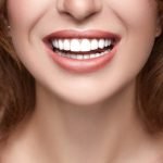 Can Bridges be Attached to Crowns