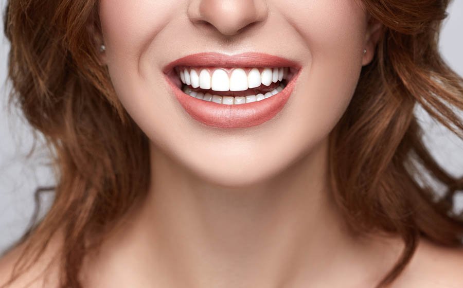 Can Bridges be Attached to Crowns