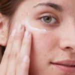 Are Eyelashes, Melasma, and Acne