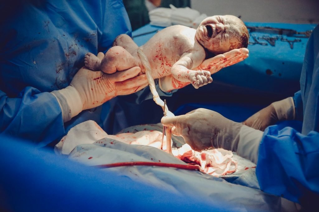 What is Obstetric Negligence in a Birth Injury Case