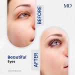 7 Tips to Take Care of Your Eyelashes
