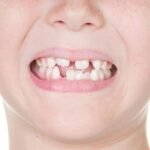 Dentistry for Children's Dental Restoration