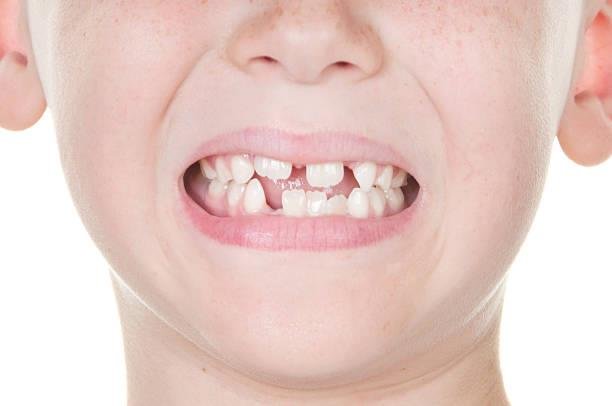 Dentistry for Children's Dental Restoration