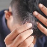 Maintain Your Hair System