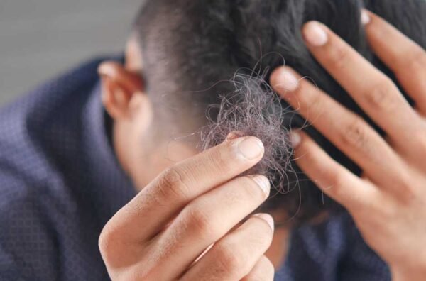 Maintain Your Hair System