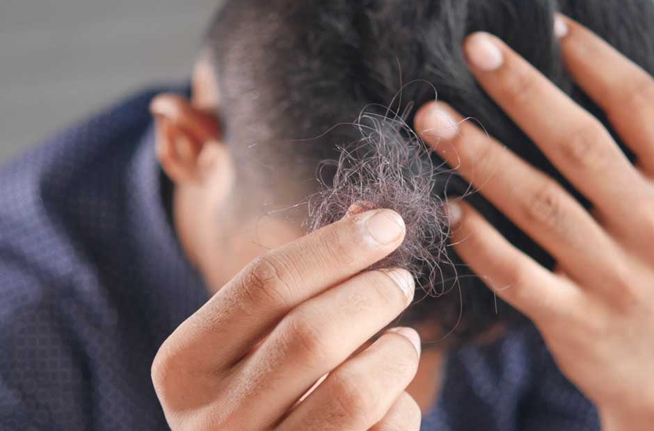 Maintain Your Hair System