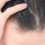 Treating the root cause of hair loss