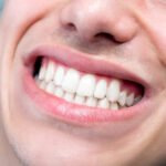 dental problem