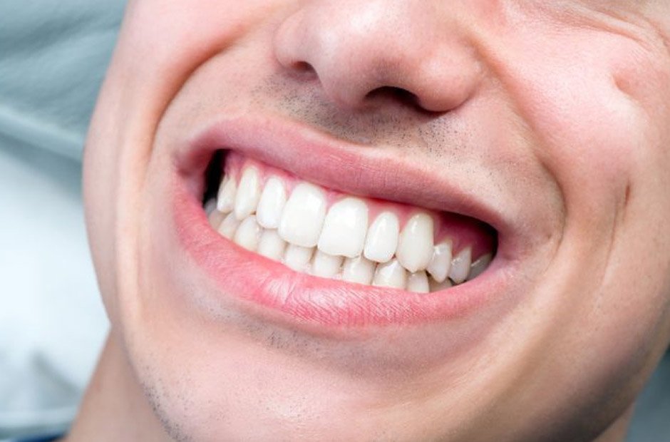 dental problem