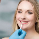 A Comprehensive Guide to Veneers