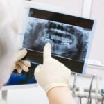 Pediatric Dental X-Rays