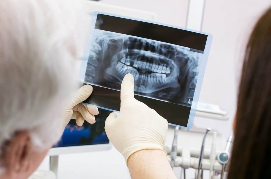 Pediatric Dental X-Rays