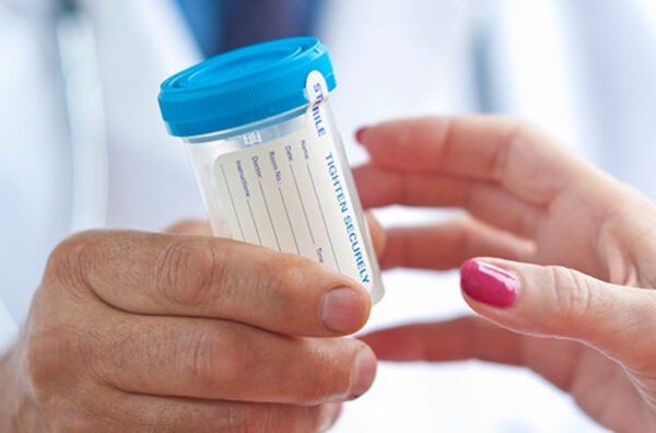 Pre-Employment Drug Screening