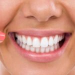 Whiten Cracked Teeth