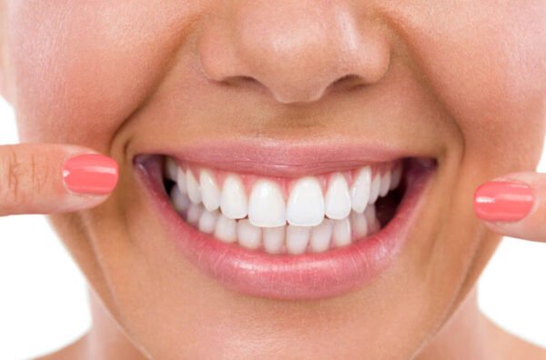 Whiten Cracked Teeth