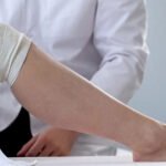 Unveiling the Mysteries of Varicose Veins