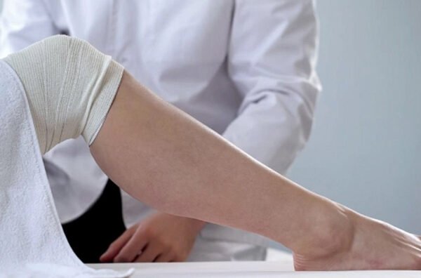 Unveiling the Mysteries of Varicose Veins