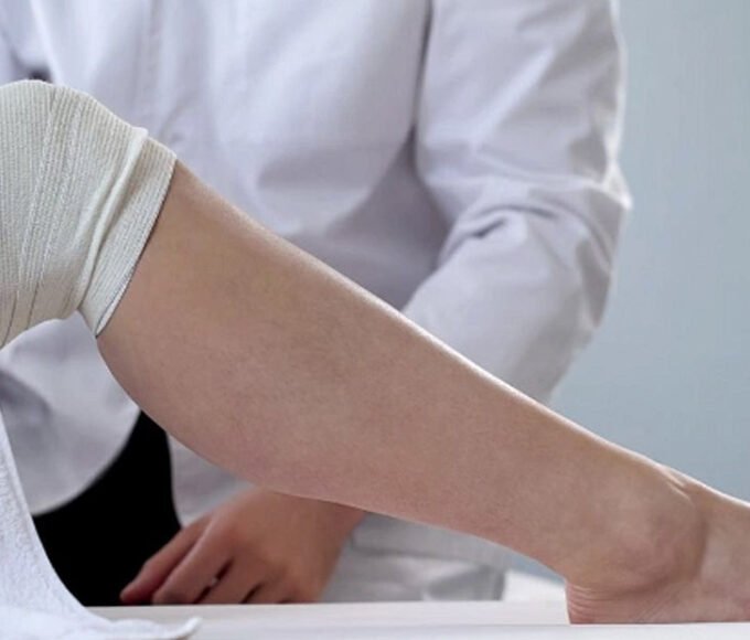 Unveiling the Mysteries of Varicose Veins