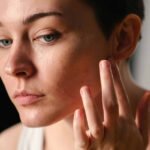 Morpheus8 in Skincare