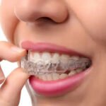 Orthodontics and Aesthetics