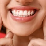 Top Tips for Healthy Teeth