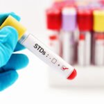 STD Testing