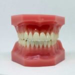 Tooth Loss in Adults