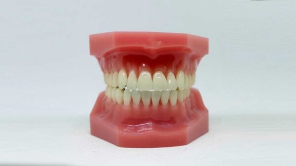 Tooth Loss in Adults