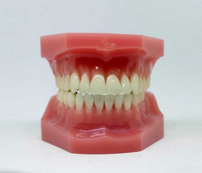 Tooth Loss in Adults
