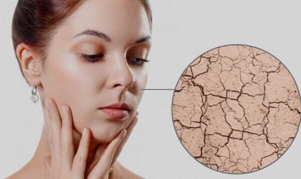 How to Tackle Seasonal Skin Challenges