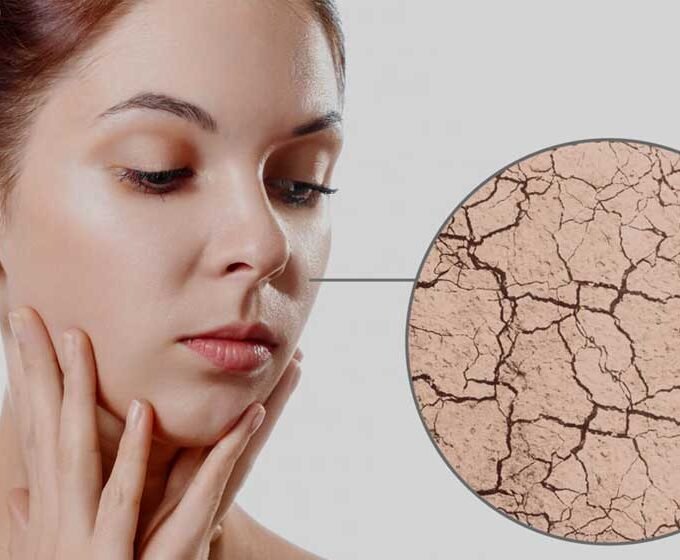 How to Tackle Seasonal Skin Challenges
