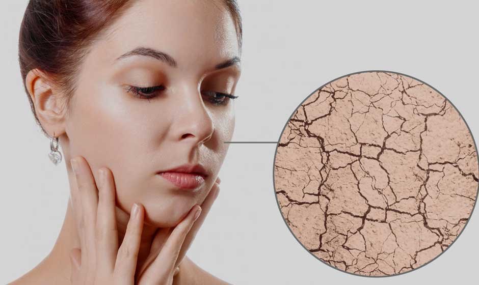 How to Tackle Seasonal Skin Challenges